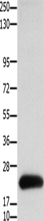 Anti-Human/Mouse Claudin 4 Antibody - ABMIUM