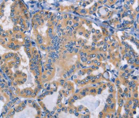 Anti-Human/Mouse DOK4 Antibody