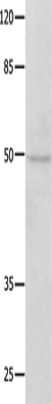 Anti-Human/Mouse/Rat NAP1L1 Antibody - ABMIUM