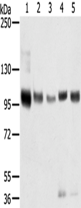 Anti-Human/Mouse/Rat SORT1 Antibody - ABMIUM