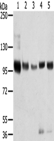 Anti-Human/Mouse/Rat SORT1 Antibody - ABMIUM