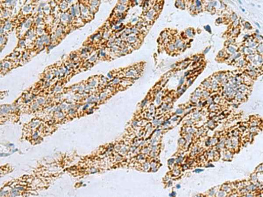 Anti-Human/Mouse/Rat PYCR2 Antibody