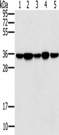 Anti-Human/Mouse/Rat PPP1CC Antibody - ABMIUM