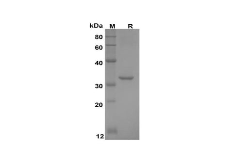 SDS-PAGE analysis of Human CXCL9/MIG proteins, 2 μg/lane of Recombinant Human CXCL9/MIG proteins was resolved with SDS-PAGE under reducing conditions, showing bands at 32 kDa.