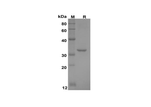 SDS-PAGE analysis of Human CXCL9/MIG proteins, 2 μg/lane of Recombinant Human CXCL9/MIG proteins was resolved with SDS-PAGE under reducing conditions, showing bands at 32 kDa.
