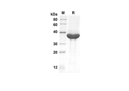SDS-PAGE analysis of Mouse CCL3 proteins, 2 μg/lane of Recombinant Mouse CCL3 proteins was resolved with an SDS-PAGE under reducing conditions, showing bands at 32.5 kDa.