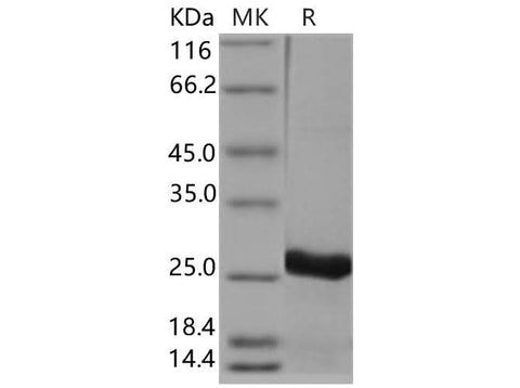 Recombinant Human UBE2T Protein (His Tag) - ABMIUM