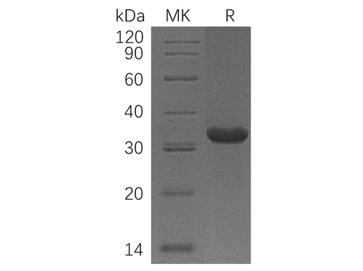 Recombinant Human C1QBP Protein (aa 74-282, His Tag) - ABMIUM
