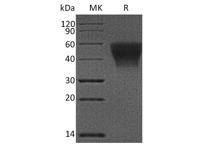 Recombinant Human CD16b/FCGR3B Protein (aa 17-208, His Tag) - ABMIUM