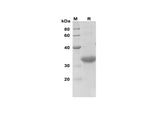 SDS-PAGE analysis of Human CCND1 proteins, 2 μg/lane of Recombinant Human CCND1 proteins was resolved with SDS-PAGE under reducing conditions, showing bands at 32 kDa.