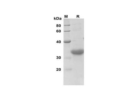 SDS-PAGE analysis of Human CCND1 proteins, 2 μg/lane of Recombinant Human CCND1 proteins was resolved with SDS-PAGE under reducing conditions, showing bands at 32 kDa.
