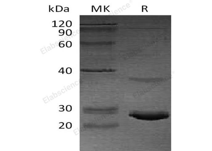 Recombinant Human Calcitonin/CALCA Protein (His Tag, E. coli) - ABMIUM