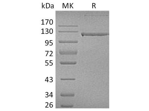 Recombinant Human CD31/PECAM1 Protein (Fc Tag) - ABMIUM