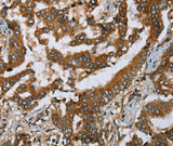 Anti-Human/Mouse PLXNB1 Antibody - ABMIUM