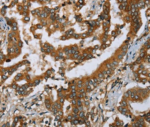 Anti-Human/Mouse PLXNB1 Antibody - ABMIUM