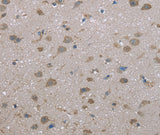 Anti-Human/Mouse FAP Antibody - ABMIUM
