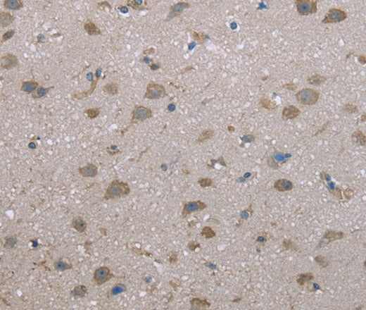 Anti-Human/Mouse FAP Antibody - ABMIUM