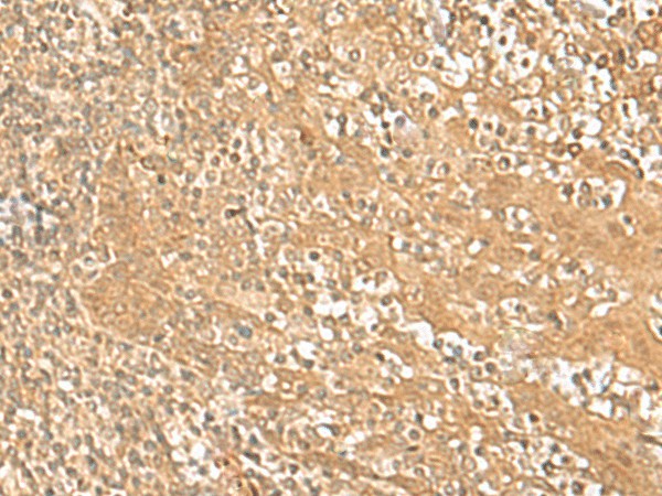 Immunohistochemistry of paraffin-embedded Human tonsil tissue using HMBOX1 Polyclonal Antibody at dilution of 1:30(×200)