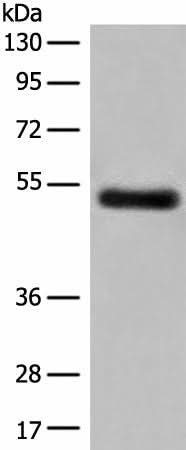 Western blot analysis of Human breast cancer tissue lysate using GK5 Polyclonal Antibody at dilution of 1:500