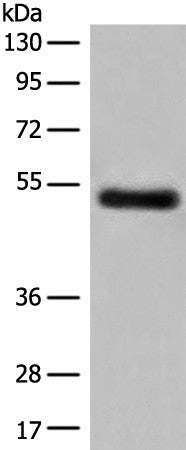 Western blot analysis of Human breast cancer tissue lysate using GK5 Polyclonal Antibody at dilution of 1:500