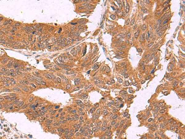 Anti-Human ZBTB33 Antibody