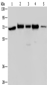 Anti-Human/Mouse/Rat AGFG1 Antibody - ABMIUM