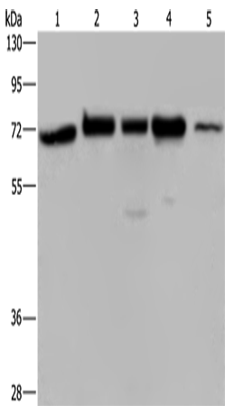 Anti-Human/Mouse/Rat AGFG1 Antibody - ABMIUM