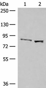 Western blot analysis of Human hepatocellular carcinoma tissue and HepG2 cell lysates using SLC26A3 Polyclonal Antibody at dilution of 1:250