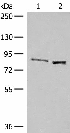 Western blot analysis of Human hepatocellular carcinoma tissue and HepG2 cell lysates using SLC26A3 Polyclonal Antibody at dilution of 1:250