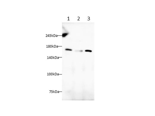 Anti-Human/Mouse/Rat PGFRA Antibody - ABMIUM
