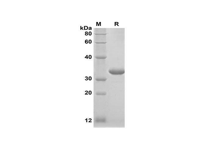 Recombinant Human INHBA Protein(Sumo Tag) - ABMIUM