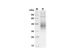SDS-PAGE analysis of Mouse CD30 Ligand/TNFSF8 proteins, 2 μg/lane of Recombinant Mouse CD30 Ligand/TNFSF8 proteins was resolved with SDS-PAGE under reducing conditions, showing bands at 40 kDa.