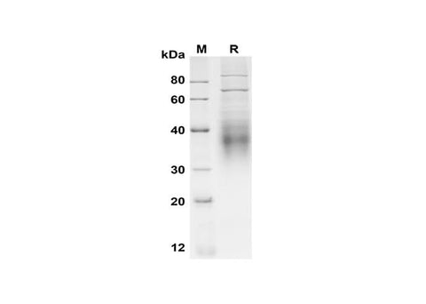 SDS-PAGE analysis of Mouse CD30 Ligand/TNFSF8 proteins, 2 μg/lane of Recombinant Mouse CD30 Ligand/TNFSF8 proteins was resolved with SDS-PAGE under reducing conditions, showing bands at 40 kDa.