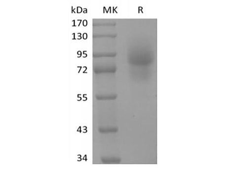 Recombinant Human CD68/SR-D1 (C-Fc) - ABMIUM