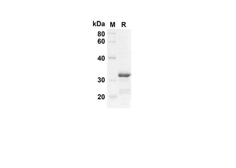SDS-PAGE analysis of Mouse MDC/CCL22 proteins, 2 μg/lane of Recombinant Mouse MDC/CCL22 proteins was resolved with an SDS-PAGE under reducing conditions, showing bands at 27.4 kDa.