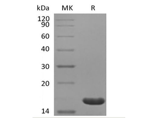 Recombinant Human IL-36 Beta/IL-1F8(153AA) - ABMIUM