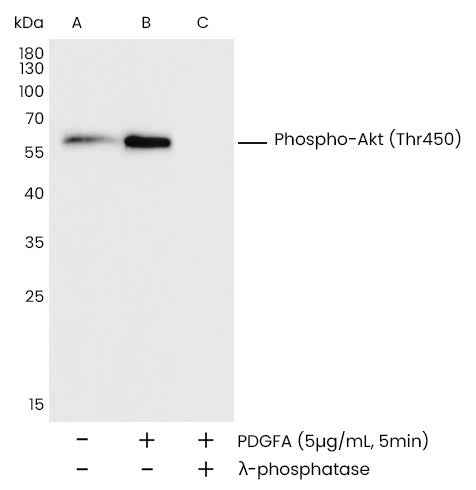 Anti-Human AKT1 Antibody [A1201] - ABMIUM