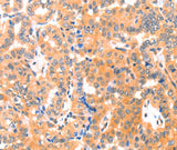 Anti-Human/Mouse THBS1 Antibody - ABMIUM