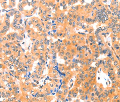 Anti-Human/Mouse THBS1 Antibody - ABMIUM