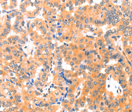 Anti-Human/Mouse THBS1 Antibody - ABMIUM