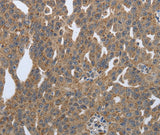 Anti-Human PDIA2 Antibody - ABMIUM
