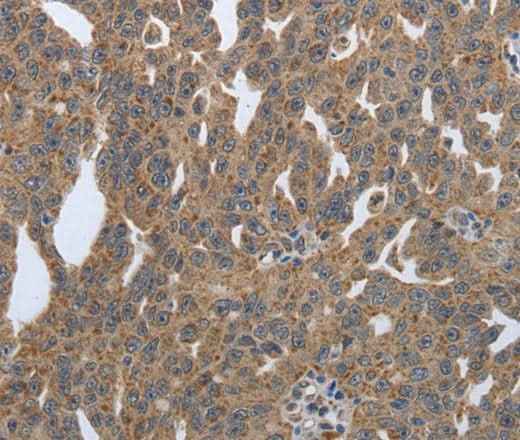 Anti-Human PDIA2 Antibody