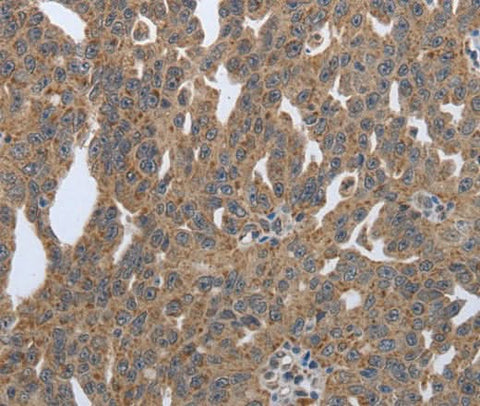 Anti-Human PDIA2 Antibody - ABMIUM