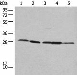 Anti-Human/Mouse/Rat RPL14 Antibody - ABMIUM
