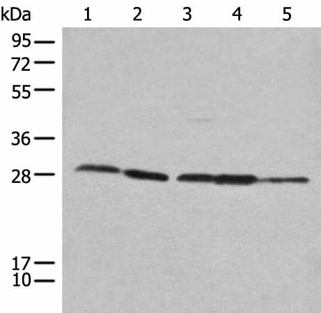 Anti-Human/Mouse/Rat RPL14 Antibody - ABMIUM