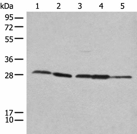 Anti-Human/Mouse/Rat RPL14 Antibody - ABMIUM