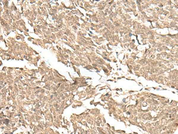 Anti-Human/Mouse KDM2A Antibody