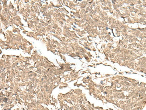 Anti-Human/Mouse KDM2A Antibody - ABMIUM