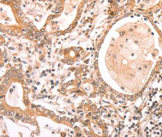 Anti-Human/Mouse/Rat ABCF1 Antibody