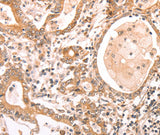 Anti-Human/Mouse/Rat ABCF1 Antibody - ABMIUM